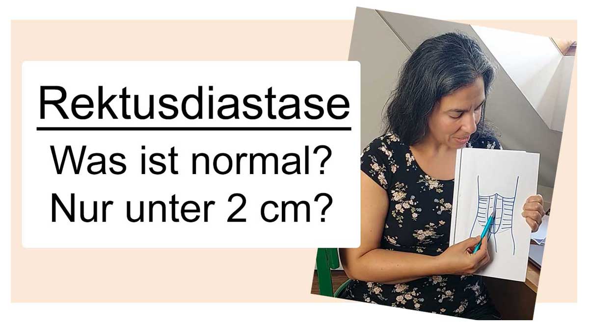 Wie breit darf die Rektusdiastase sein?
